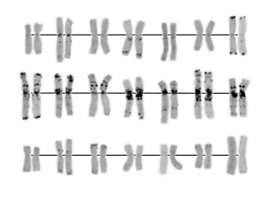 Кариотип сорта Добрыня (Анализ сделан Бадаевой Е.Д. (ИОГен РАН))